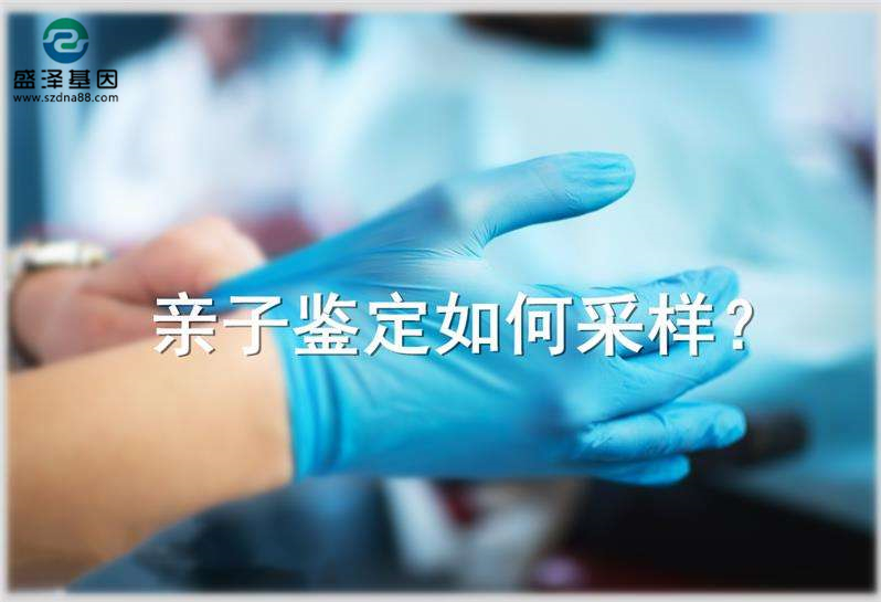 偷偷撿了一把頭發可以送去做親子鑒定嗎?