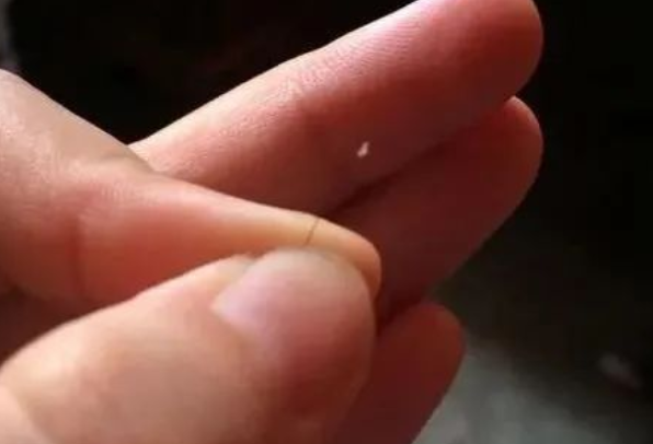 掉落的毛囊毛發(fā)可以拿去做染色體親子鑒定嗎? 掉落的毛囊毛發(fā)可以拿去做染色體親子鑒定嗎?