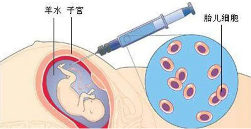 孕期做胎兒親子鑒定合適嗎?孕期有哪些胎兒親子鑒定方法?