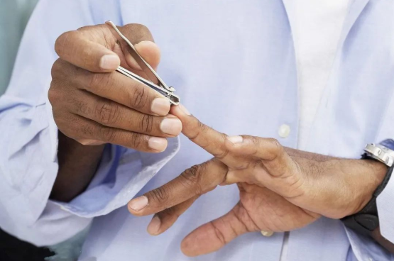 指甲是否含有DNA,可作為親子鑒定樣本嗎? 指甲是否含有DNA,可作為親子鑒定樣本嗎?