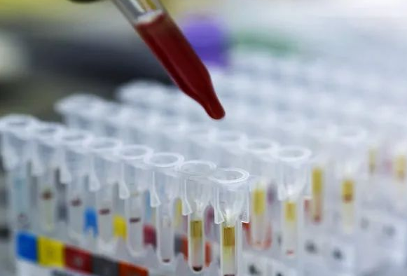 DNA親子鑒定會(huì)出錯(cuò)嗎?根據(jù)樣本檢測(cè)位點(diǎn)出錯(cuò)的概率是多少呢?