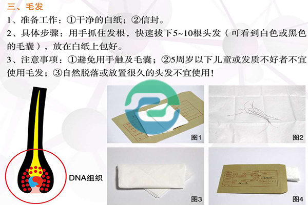 如何委托中山個人親子鑒定？用頭發怎么做親子鑒定？