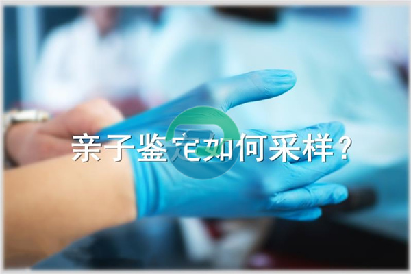 中山親子鑒定和親緣鑒定是一樣的嗎?